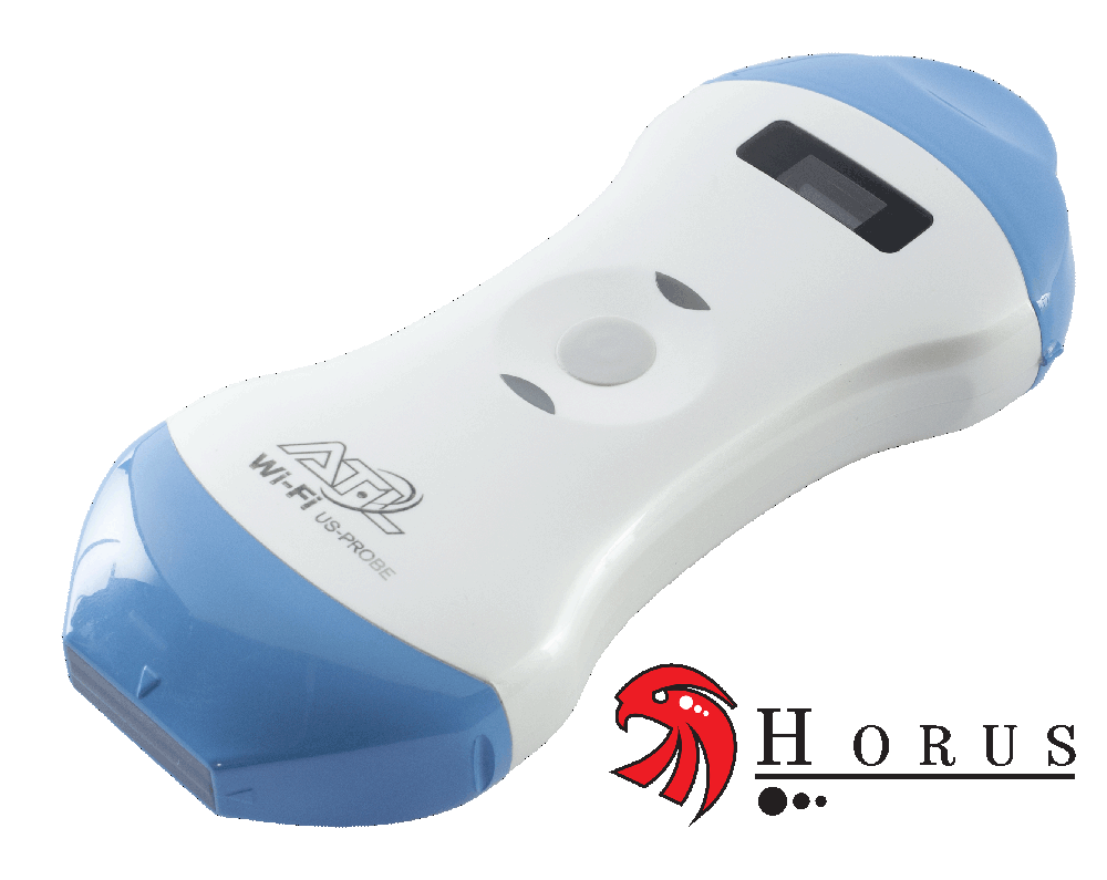 Horus-Wireless-Ultrasound-Ecografo Palmare Microconvex + Lineare