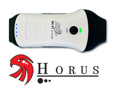 Horus-4.0-B-MATRIXSOUND-Ecografo-Palmare-Wireless-Prezzo-Lineare Cardio Phased Array
